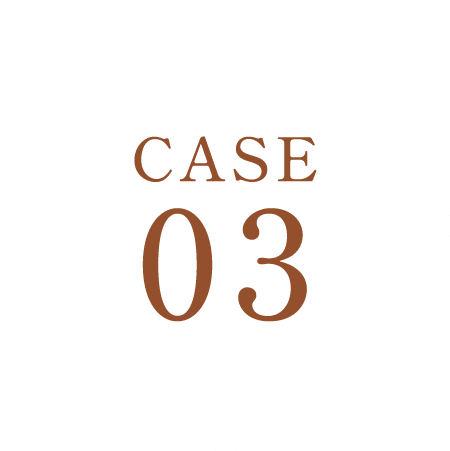 CASE03