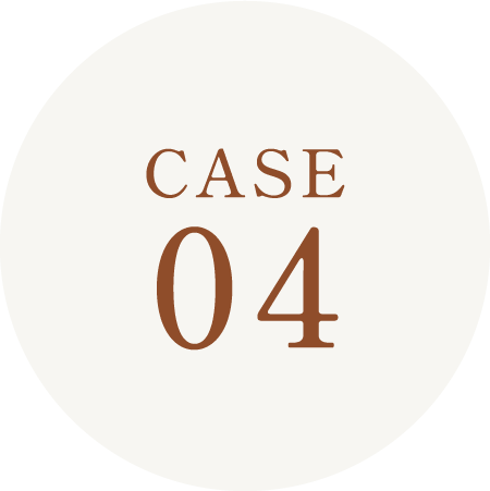 CASE04